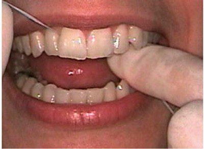 fio-dentario1
